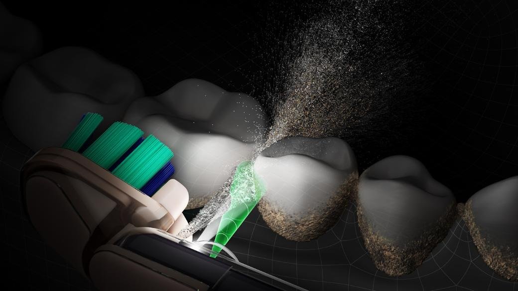 Ilustração da Dyson mostrando o jato de enxaguante atingindo o espaço entre dois dentes